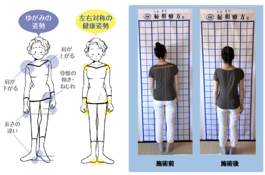 治る施術 治療院開業ならしんそう療方